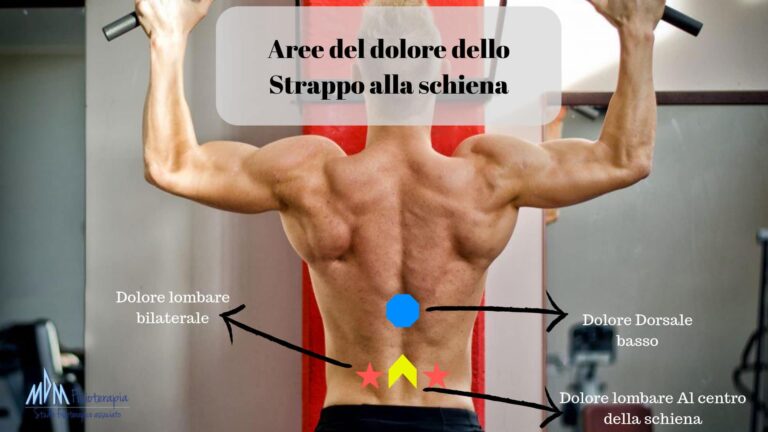 Strappo Alla Schiena Cosa Come Curarlo In Fretta