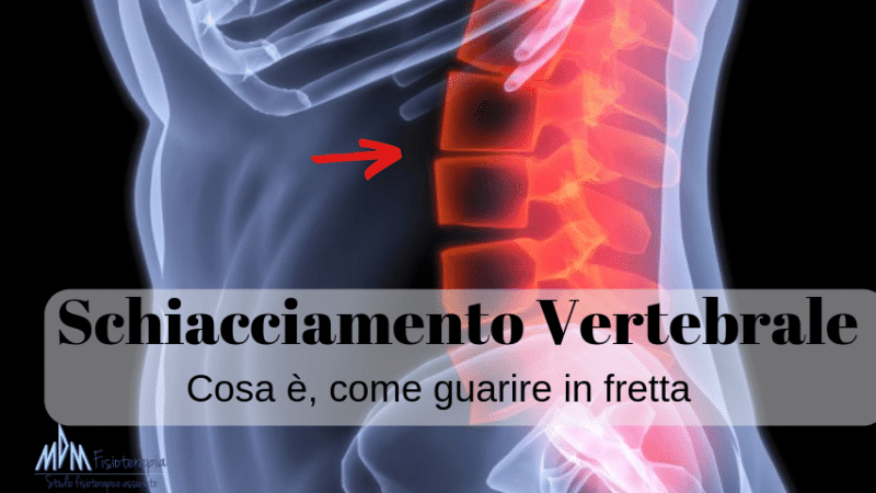 Schiacciamento vertebre